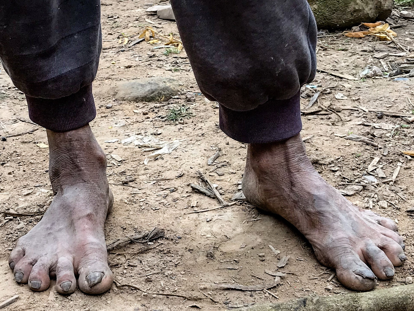 007 – Füße, China-Grenze 2018