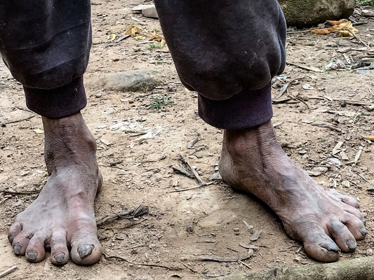 007 - Feet, China border 2018